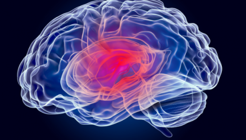 Classification des tumeurs du cerveau 