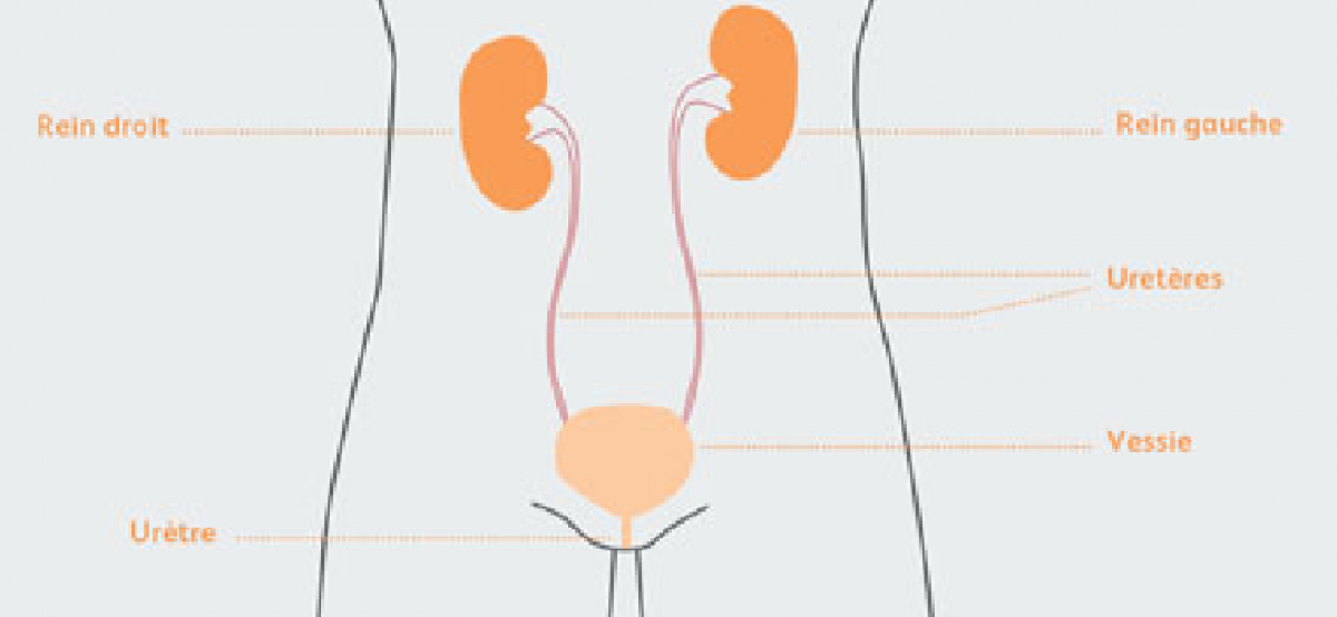 Le cancer du rein