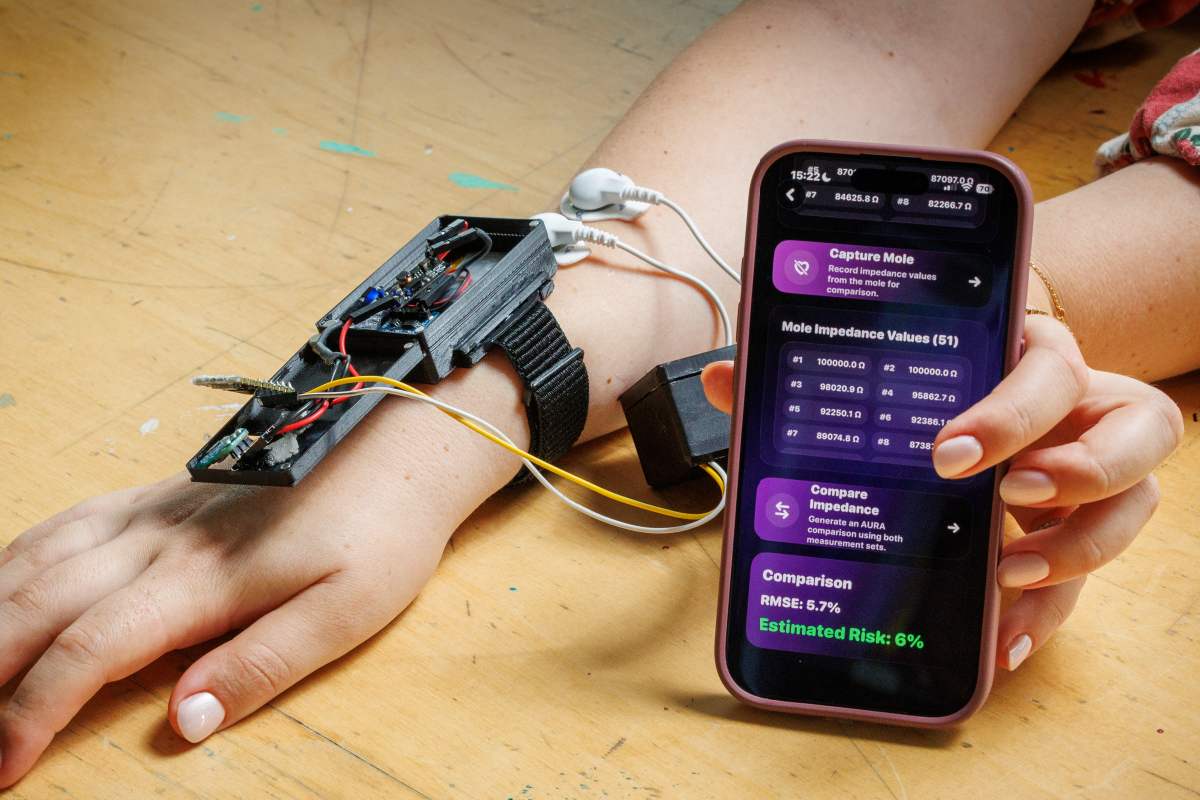 Bracelet intelligent AURA pour la prévention du cancer de la peau