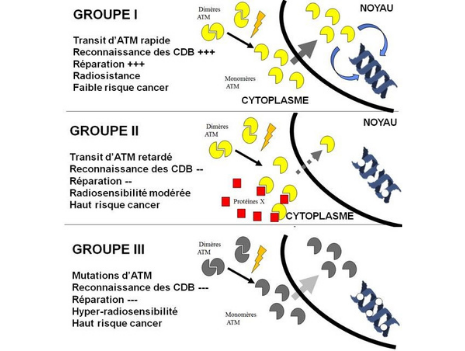 Schéma : Radiosensibilité individuelles des patients atteints de cancer