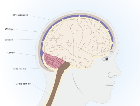 Shéma - Tumeurs du cerveau