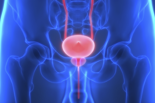 Was man über Prostatakrebs wissen sollte