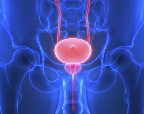 Ce qu'il faut savoir sur le cancer de la prostate