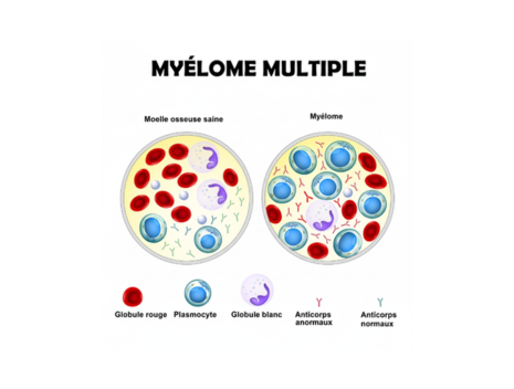 A propos du myélome multiple